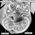 fig 9a Human CS 14 heart atrioventricular canal (EFIC)