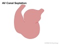 Heart septation 001 icon.jpg