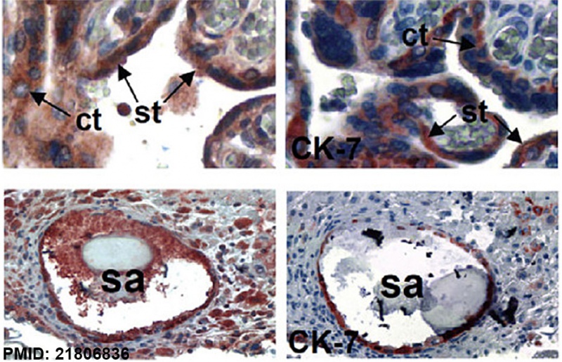 File:Human placenta SERPINE2 and CK7 expression.jpg