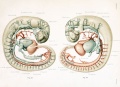 human embryo 4 mm - right and left profile views of main arteries and veins.