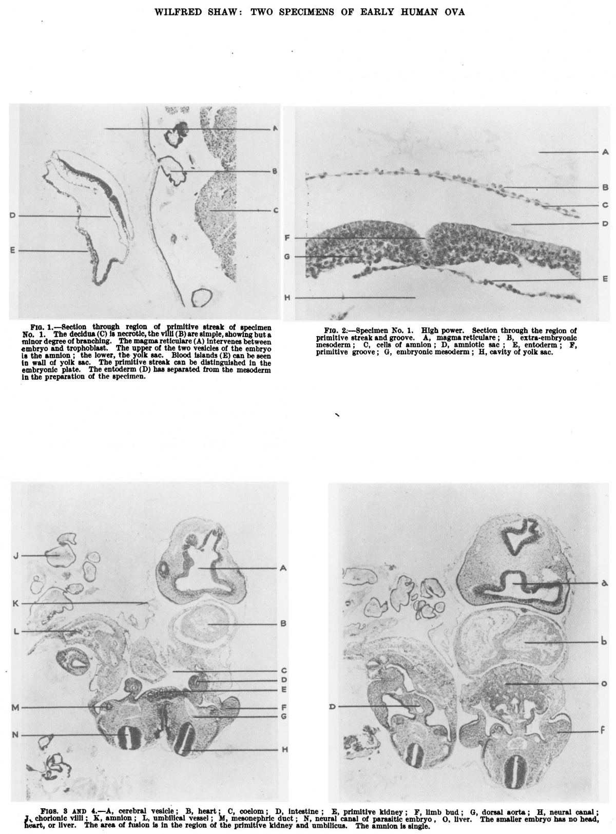 Paper - Observations on two specimens of early human ova - Embryology