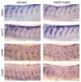Comparison of neural crest cell migration erbb3b mutants and wildtype zebrafish models