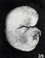 Fig. 39. Macerated, firmly rolled-up, young fetus. No. 921. X2.25.