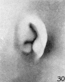 Fig. 30. No. 1980, 37 mm.