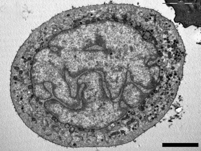 Merkel cell EM 01.jpg