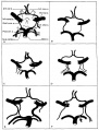 Fig. 1. Different patterns of the Circle of Willis