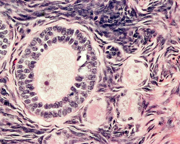 File:Monkey- ovary primordial follicle.jpg