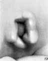 Fig. 19. Embryo No. 899 13 mm. long. X 24.