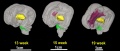 Brain-tract-development-03.jpg