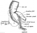 Fig. 224. Diagram of the Apex of the Caecum at the time of birth and the Diverticula which may be produced in the Fundus of the Caecum afterwards.
