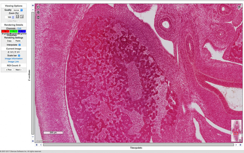 File:Embryo-1951-09-01-Slide-60 Scene11-3.jpg