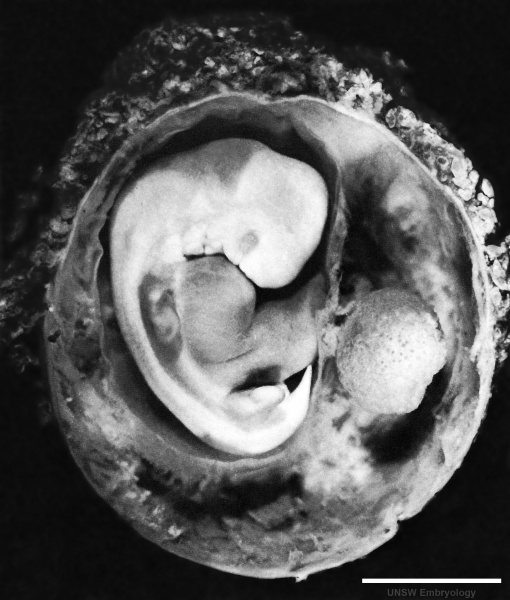 File:Stage17 embryo and membranes01.jpg