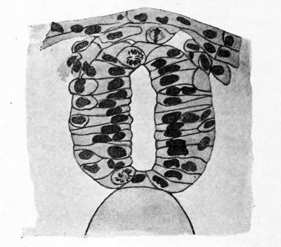 Transverse section through neural tube, neural crest and ectoderm of Amblystoma