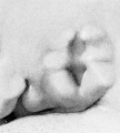 Fig. 17. Embryo No. 1232, 14 mm