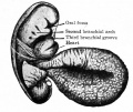 Lateral view of human embryo of 2.6 mm (His, from Keibel and Mall).