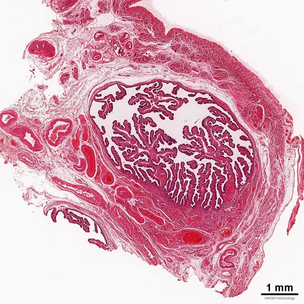 File:Uterine tube histology 05.jpg