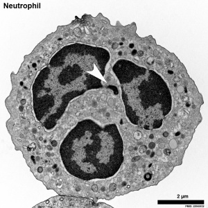 Neutrophil Barr body