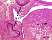 Integumentary System - Tooth Development - Embryology
