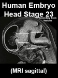 Stage23 MRI S01 icon.jpg