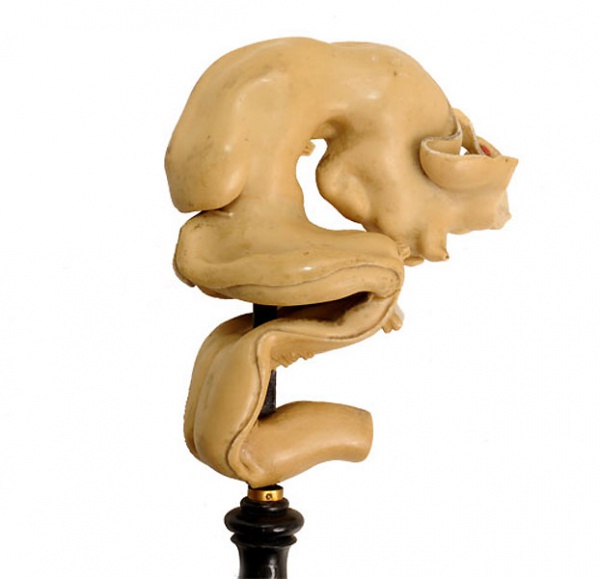 Neural - Medulla Oblongata Development - Embryology
