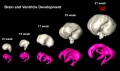 Brain and ventricle development (scaled)