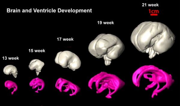 Brain ventricles and ganglia development 03.jpg