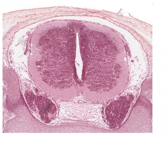 File:Human Stage22 spinal cord01.jpg