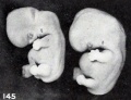 Fig. 145. Enlarged fetus from same, showing maceration effects. X2.