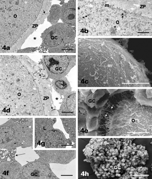 File:Mouse antral follicle.jpg