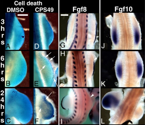 Thalidomide - limb signaling.jpg