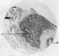 Fig. 4. Sagittal section through pineal region foetus of 4 months