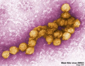 West Nile virus EM01.jpg