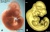 Mouse embryo E11 and tomography 01.jpg