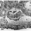 Carnegie 8004 embryo, chorionic cavity and trophoblast