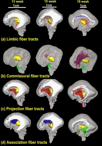 File:Brain tract development 01.jpg