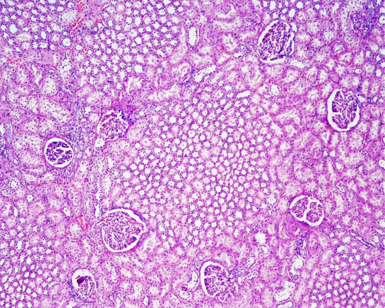 File:Renal histology 01.jpg