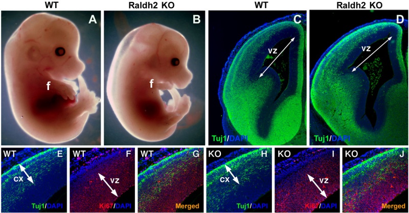 File:Mouse embryo cortex radial expansion.jpg