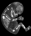 Fig 2 Embryo No. 284