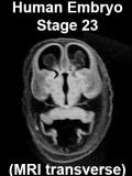 Stage23 MRI T01 icon.jpg