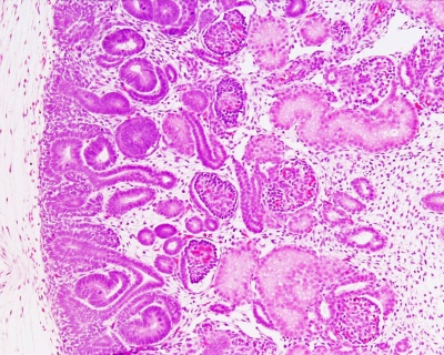 Human fetal kidney histology 01.jpg