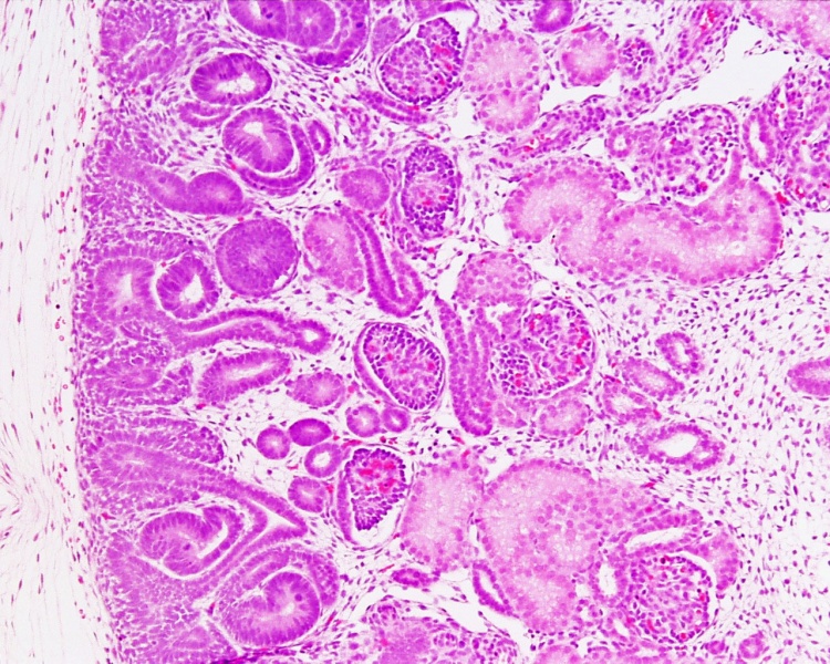 File:Human fetal kidney histology 01.jpg