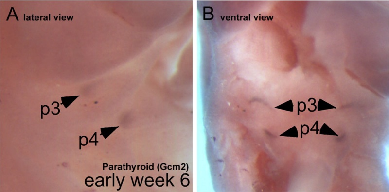 File:Human embryo parathyroid 01.jpg