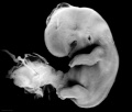 Embryo, left lateral view