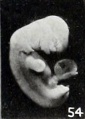 Figs. 52-63. Illustrating the absence of fundamental differences between the group of fetus compressus and grade 3 of the normal specimens. No. 1475 (fig. 54) pathological. X1.5.