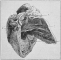 Fig. 29 Incomplete double heart