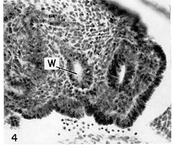 File:Faulconer1951 fig04.jpg