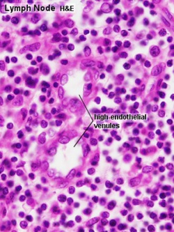 Lymph node histology 05.jpg