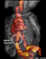 Fetal ductus venosus ultrasound