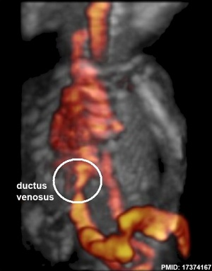 Fetal dusctus venosus ultrasound
