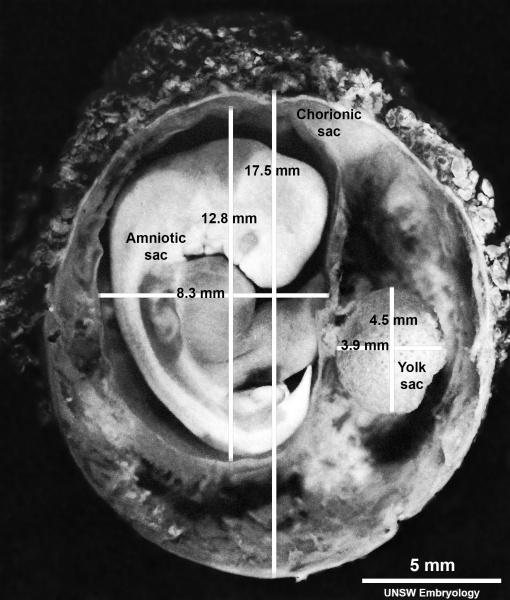 File:Stage17 embryo and membranes05.jpg